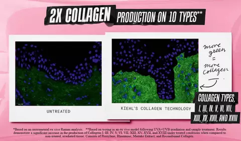 2X Collagen Production on 10 Types
