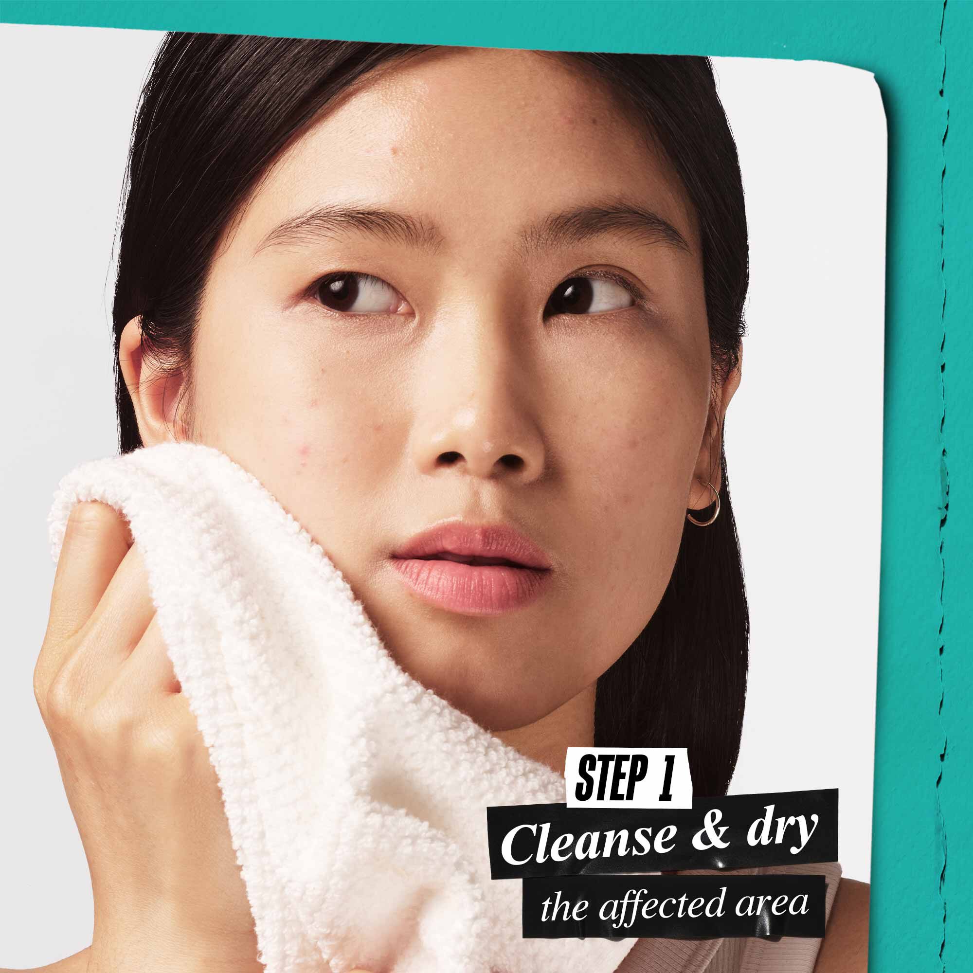 An animation of how to use the "Truly Targeted Overnight Blemish Patch" with instructions, featuring Kiehl's product packaging and hydrocolloid patches.