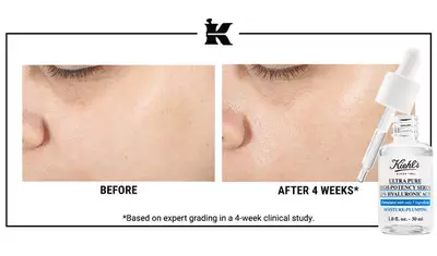 Alt text: "Comparison image showing facial skin before and after using Kiehl's Ultra Pure High-Potency Serum for four weeks. The 'before' image displays uneven skin texture, while the 'after' image shows smoother, more radiant skin."