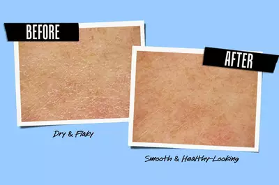Before and after comparison of skin texture; the left side shows dry and flaky skin, while the right side shows smooth and healthy-looking skin.