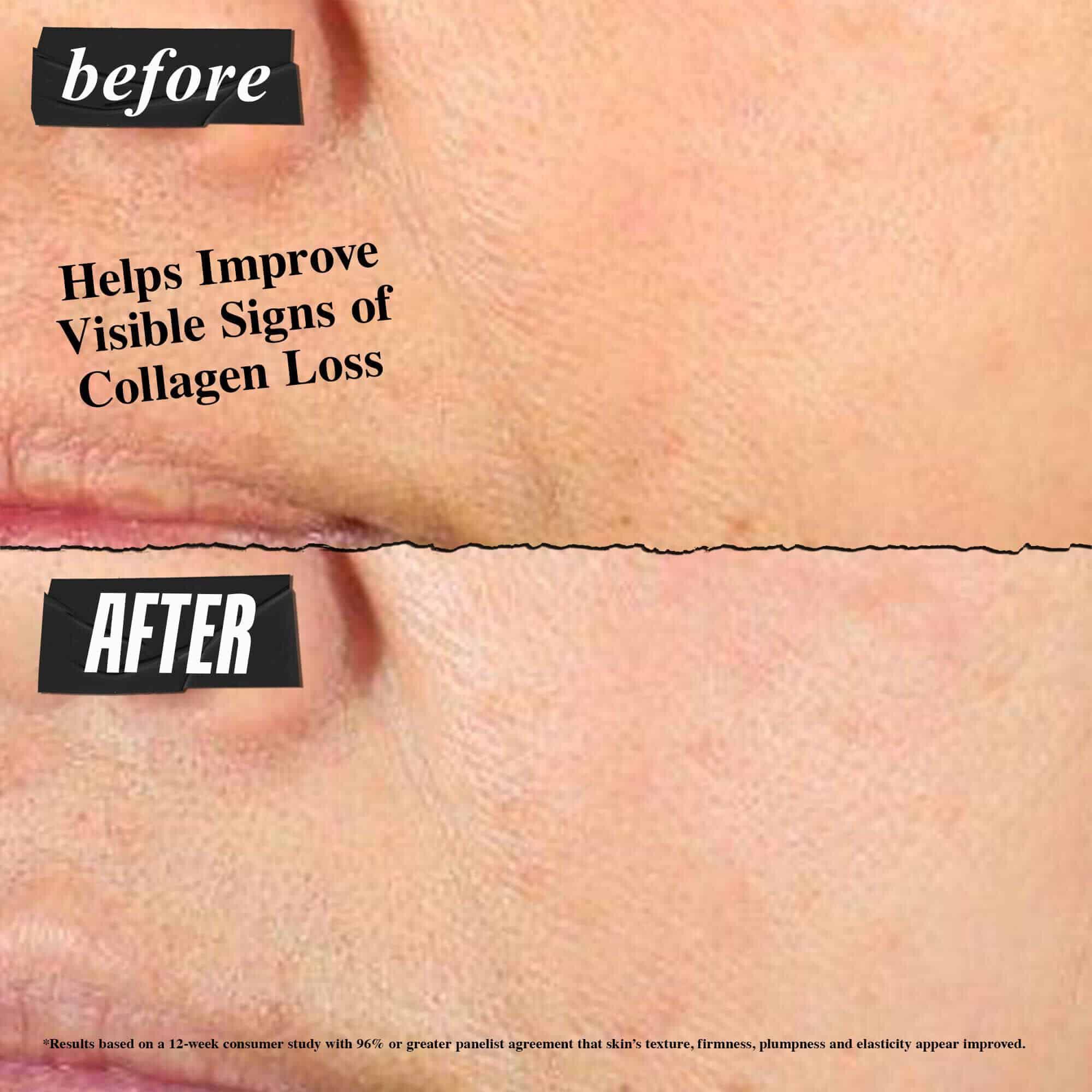 Voor- en na-foto - Kiehl's Super Multi-Corrective Cream helpt de zichtbare tekenen van collageenverlies te verbeteren