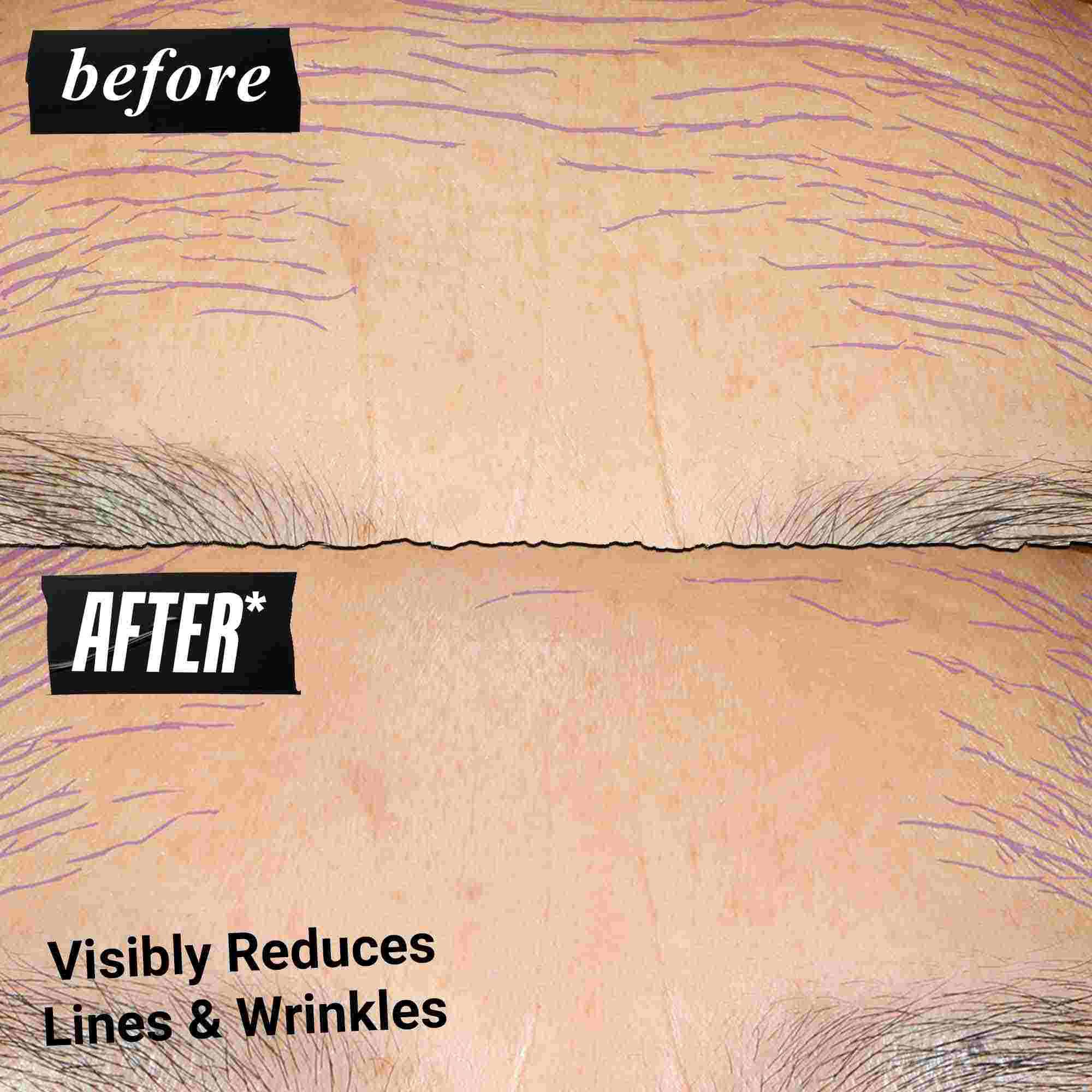 Voor- en na-foto - Kiehl's Retinol Skin Renewing Daily Microdose helpt teint en textuur te verbeteren