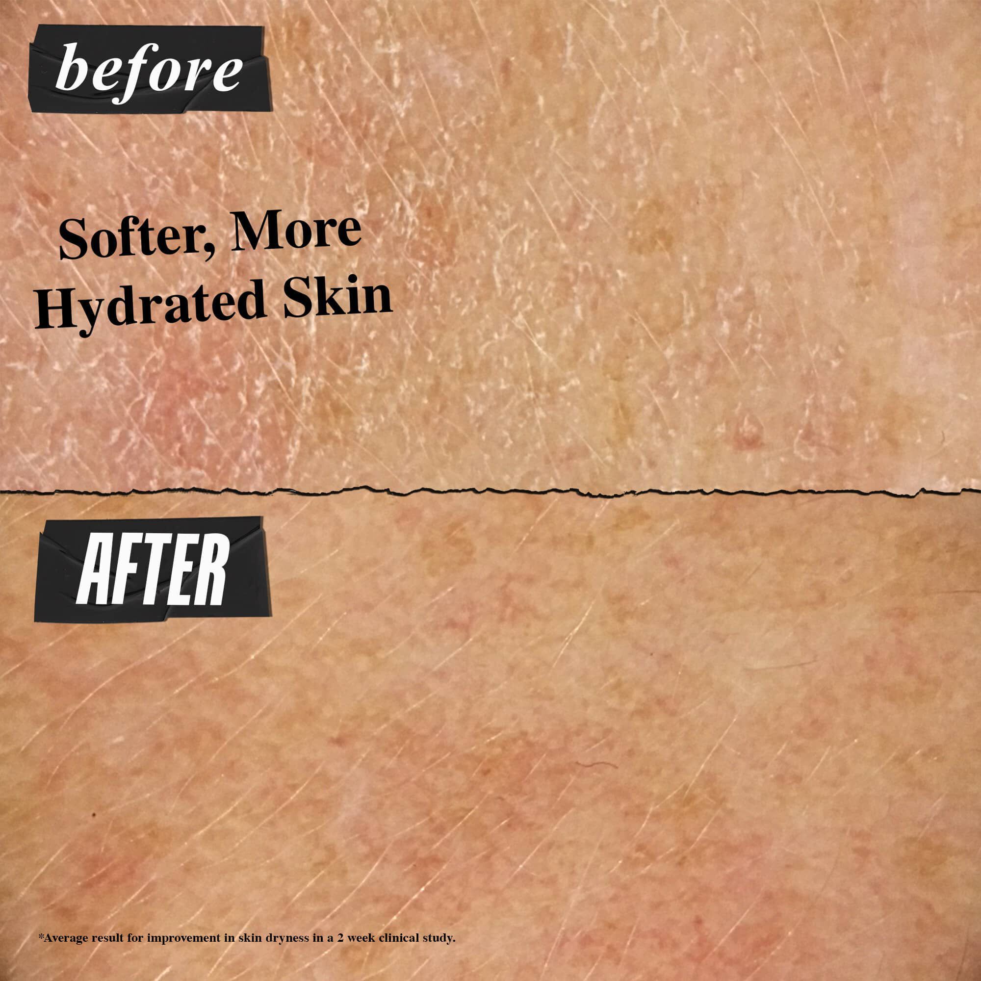 Voor- en na-foto - Ultra Facial Cream zorgt voor een zachtere, meer gehydrateerde huid
