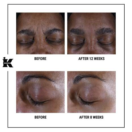 Kiehl's eye treatment new arrivals