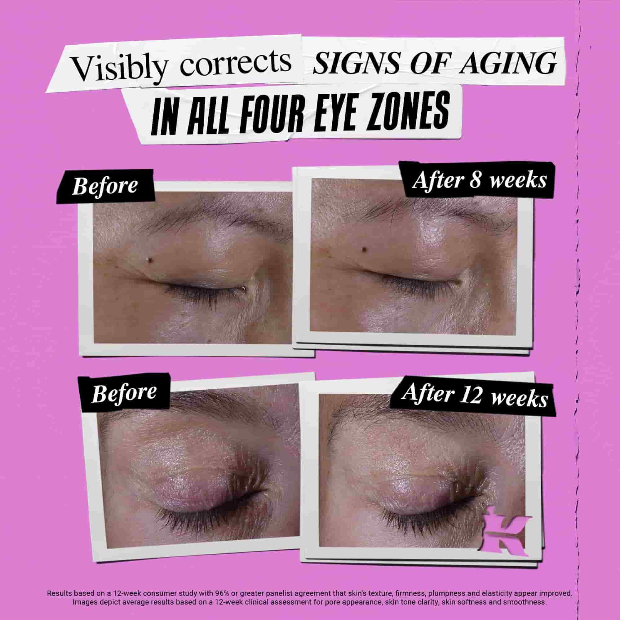 Voor- en na-foto van hoe Kiehl's Super Multi-Corrective Eye Zone Treatment tekenen van veroudering corrigeert