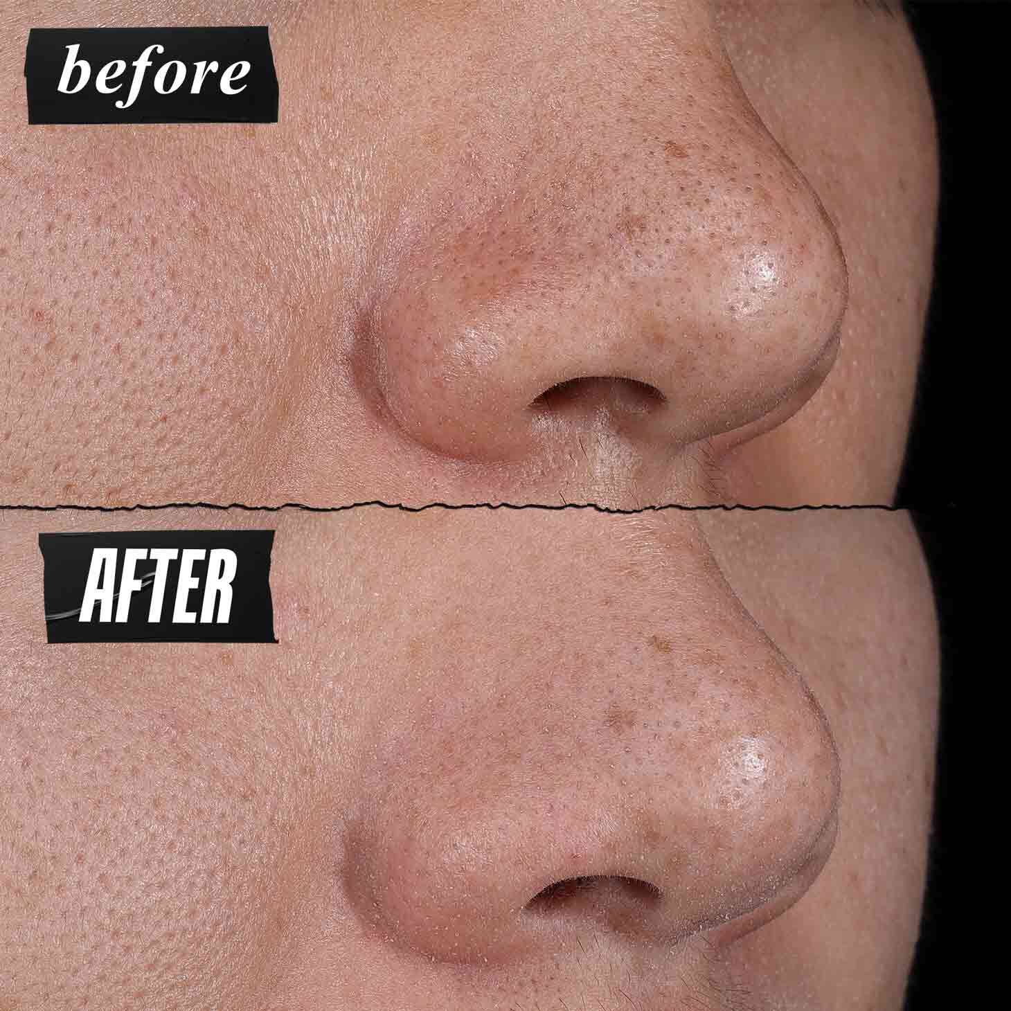 Voor- en na-foto - Kiehl's Rare Earth Deep Pore Cleansing Masque vermindert porien zichtbaar