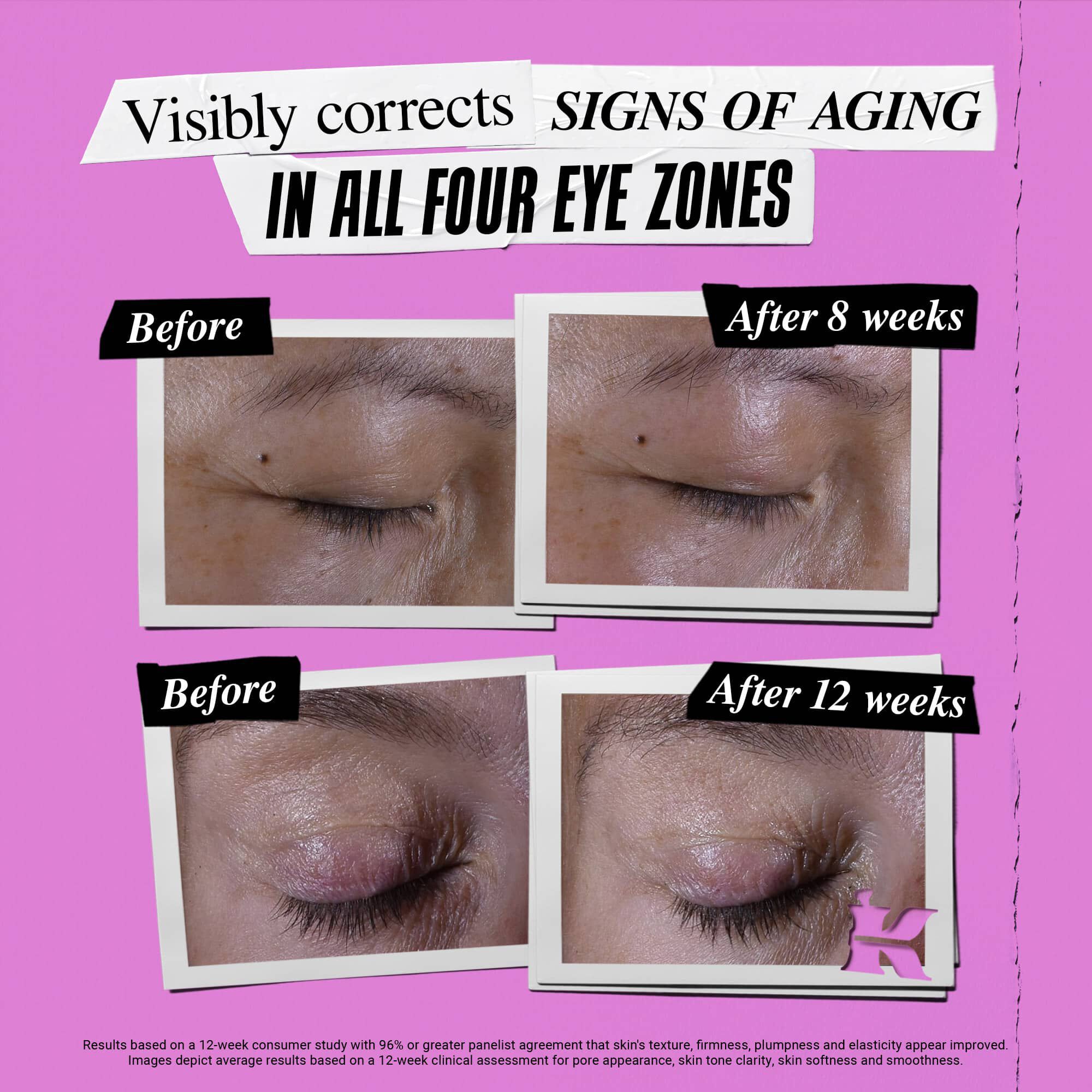 Voor- en na-foto van hoe Kiehl's Super Multi-Corrective Eye Zone Treatment tekenen van veroudering corrigeert
