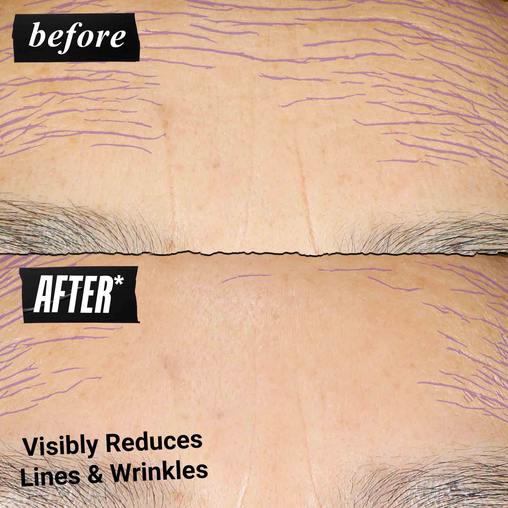 Voor- en na-foto - Kiehl's Retinol Skin Renewing Daily Microdose helpt teint en textuur te verbeteren