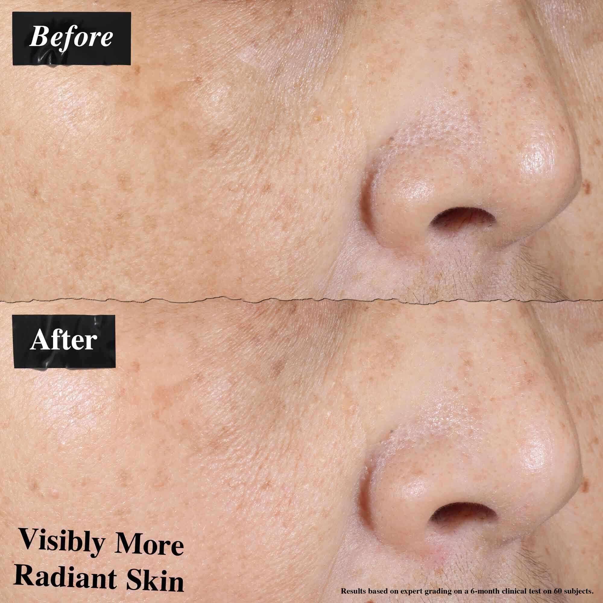 Een voor-en-na vergelijking die zichtbaar verminderde huidroodheid toont na gebruik van Ultra-Light Daily UV Defense.