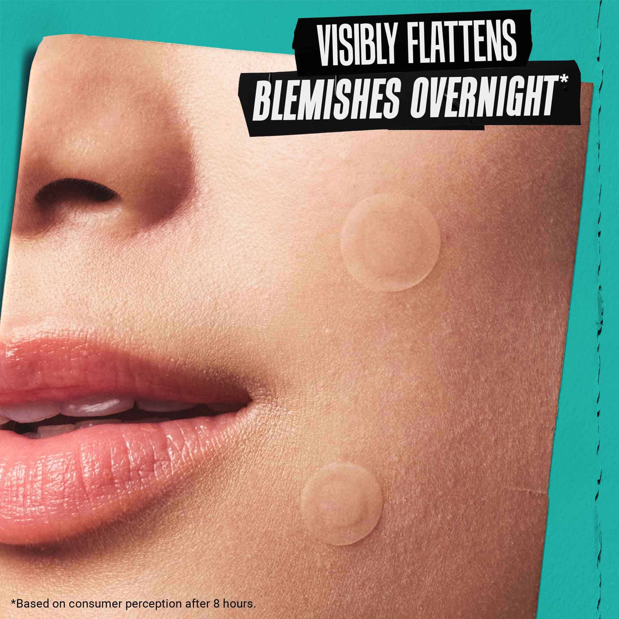 A person's face with blemish patches applied, illustrating how the product "Visibly Flattens Blemishes Overnight."
