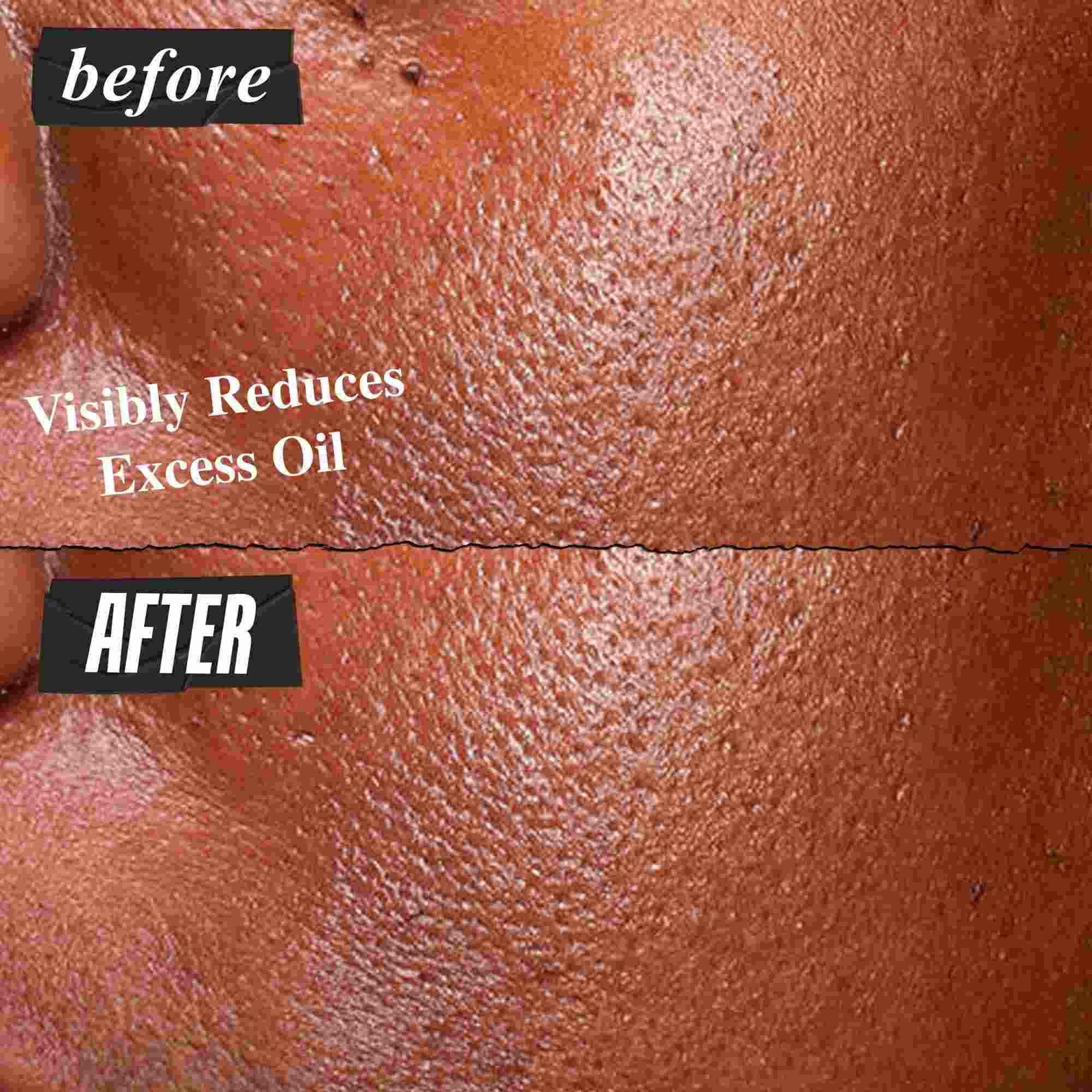 Voor- en na-foto van het Kiehl's Ultra Pure High-Potency Serum dat overtollig vet zichtbaar vermindert