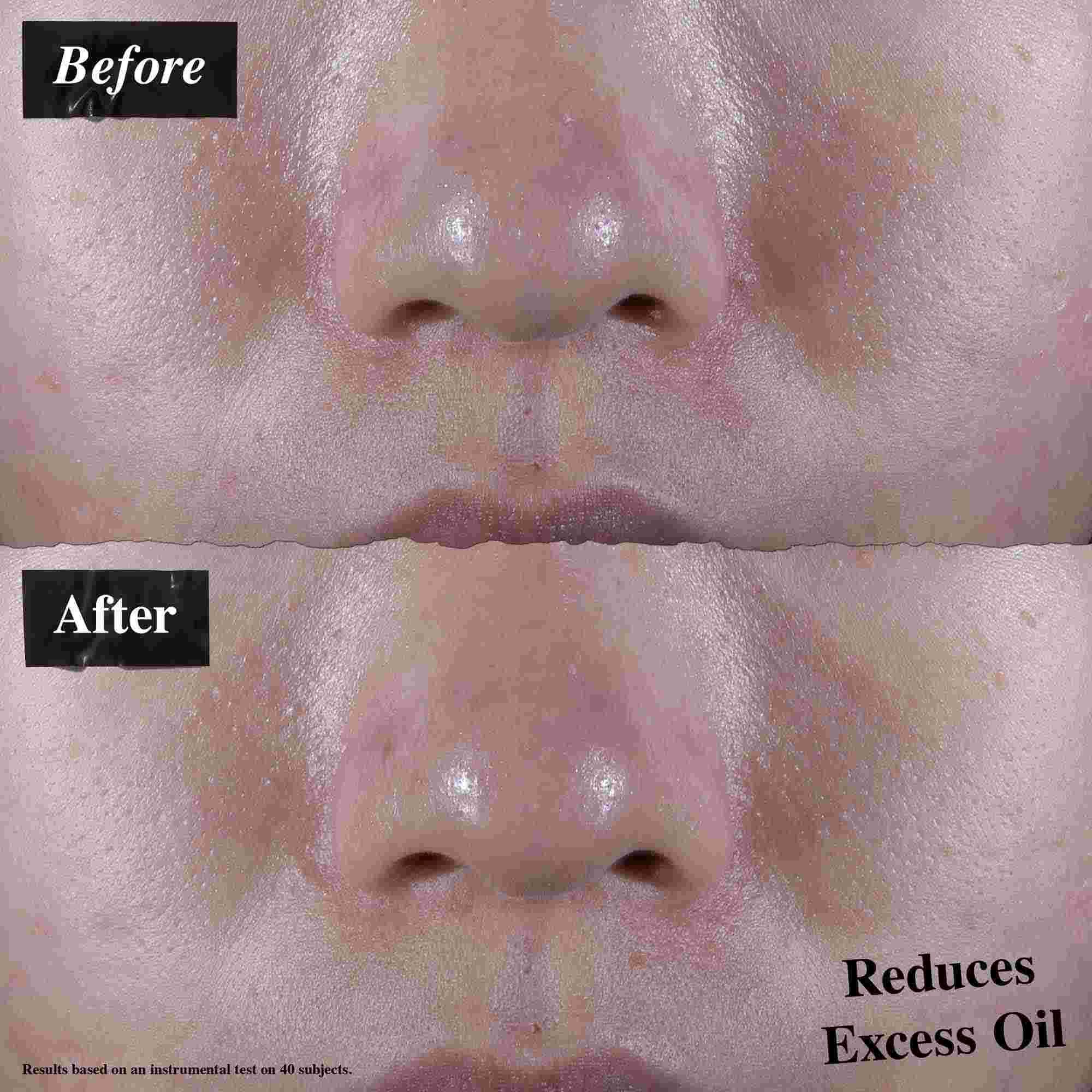 Een voor-en-na vergelijking die verminderde overtollige olie toont na gebruik van Ultra Facial Oil-Free Gel Cream.